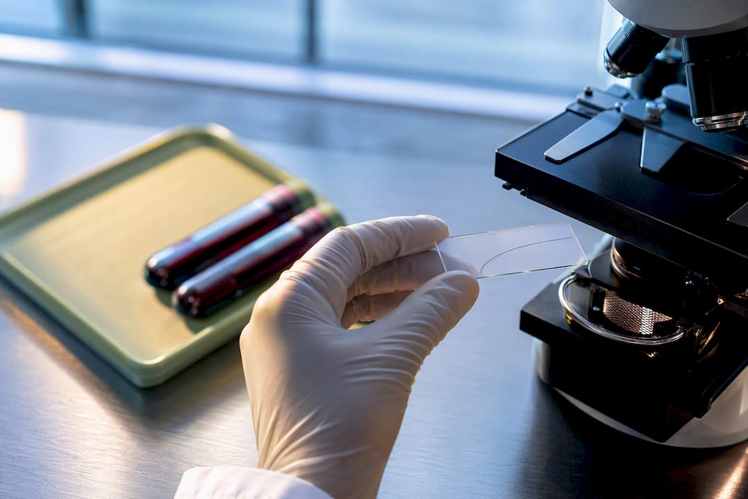 Mikroskop und Haarprobe im diagnostischen Labor